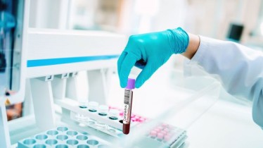 Life_sciences_pharma_Cepton